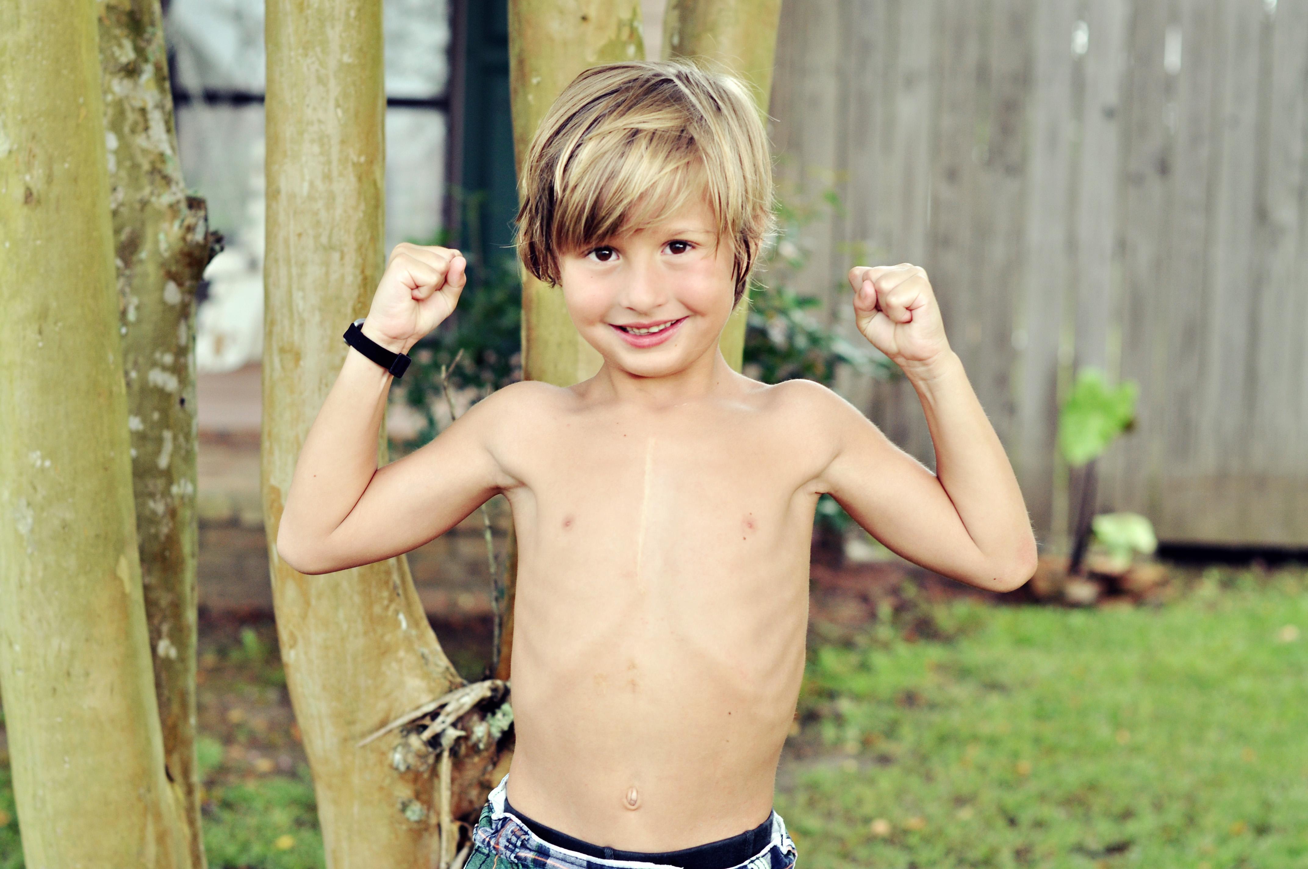Young Boy Shows off his Strength and his Scars
